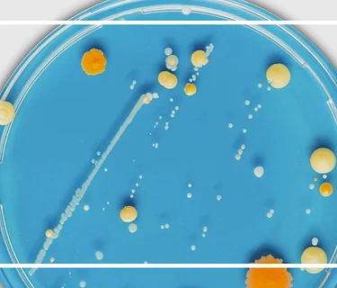 Petri Dish – Nothing is forever: What will it take to clean up PFAS in our waterways?