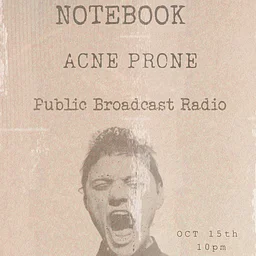 Notebook // Acne Prone // Public Broadcast Radio