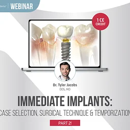 Live Webinar: Immediate Implants – Case Selection, Surgical Technique & Temporization – PART 2! | October 20th 2026 | Dr. Tyler Jacobs